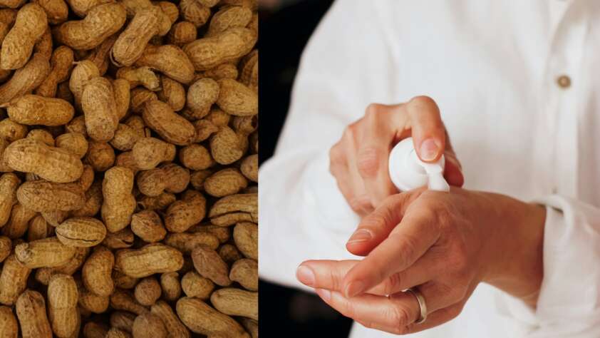 A collage of someone using lotion and a close-up image of peanuts.
