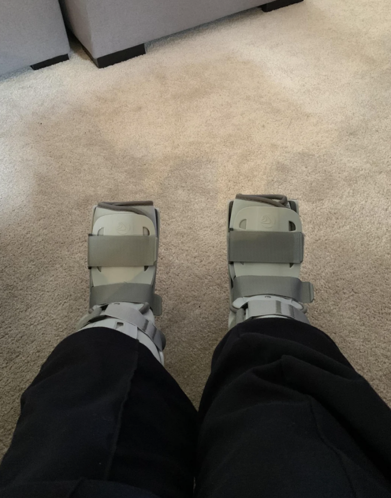 An image from someone who broke both of their feet in one night. 