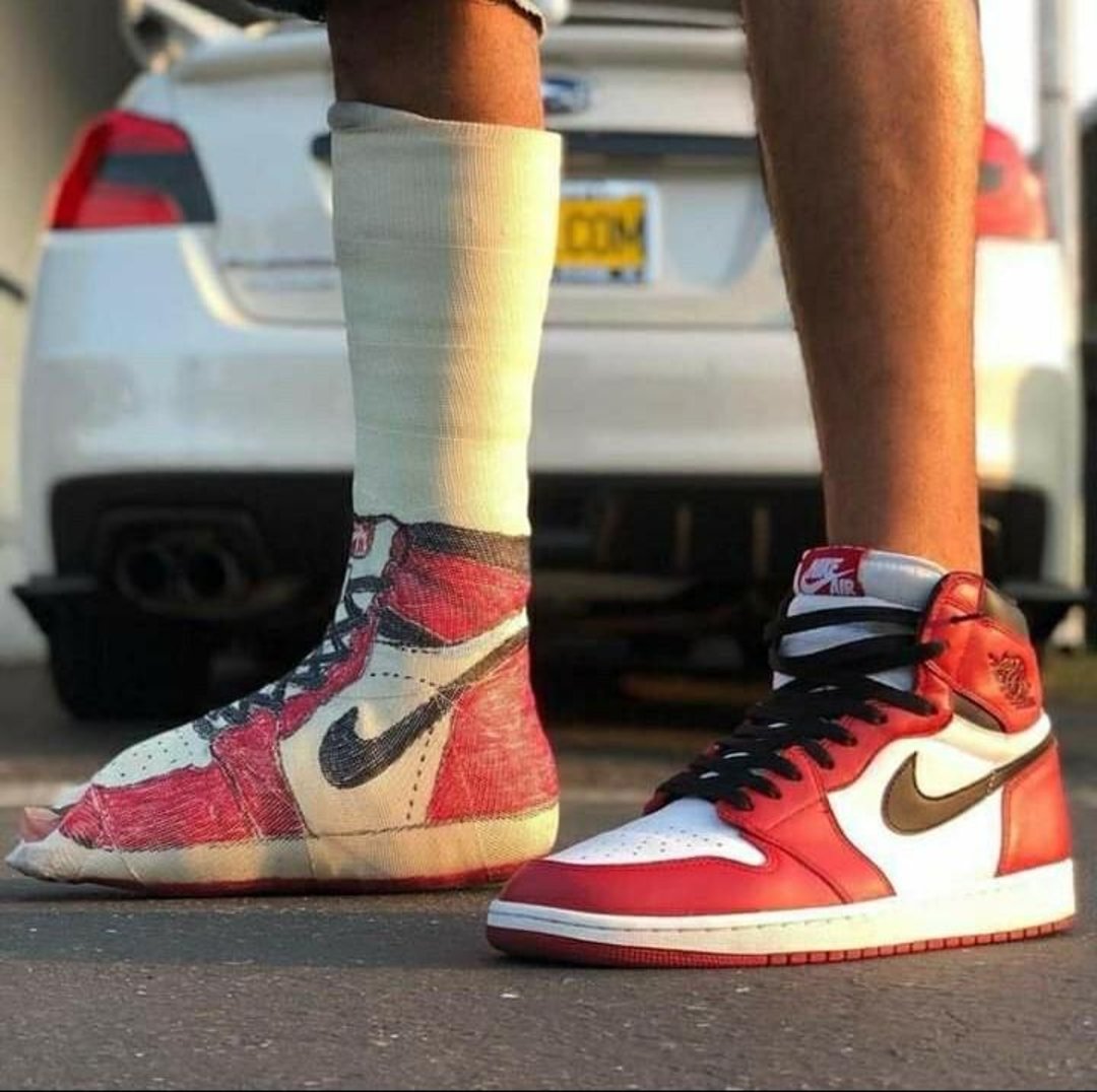 A person stands next to a white car wearing a red, white, and black Nike Air Jordan shoe on one foot, while the other foot is in a cast painted to resemble the same shoe.