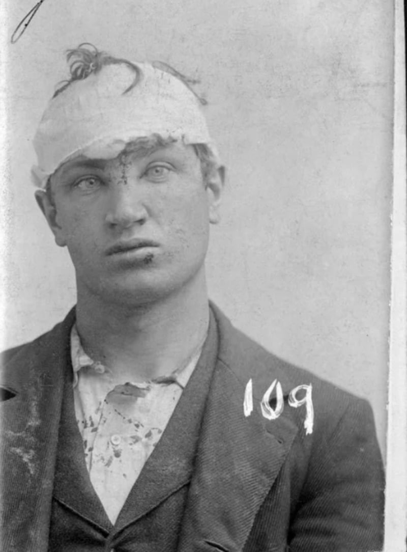 Black-and-white photo of a man wearing a suit with a bandaged head, visible facial injuries, and bloodstains on his shirt. The number 109 is written on the image.