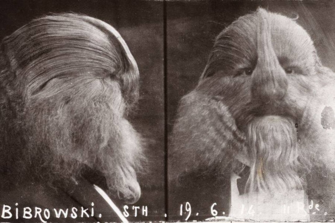 Two black-and-white portrait photos show a person with long hair and facial hair covering most of their face, giving a unique appearance. The left side is a profile view; the right side is a front view. Text appears at the bottom.