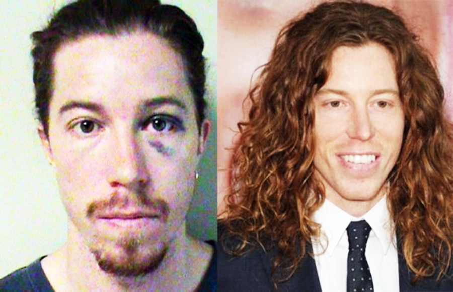 Side-by-side photos of the same man: on the left, he has a black eye, serious expression, and tied-back hair; on the right, he is smiling, with long curly hair and wearing a suit and tie.