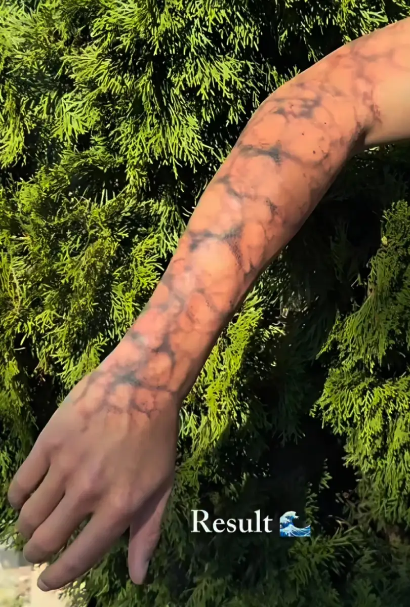 A hand and forearm are extended in front of green foliage, casting dappled shadows that look like webbed patterns on the skin. The word "Result" and a wave emoji appear at the bottom of the image.