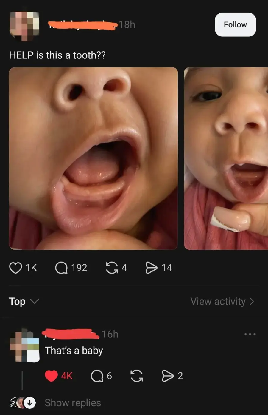 Two close-up photos of a baby’s open mouth, possibly showing a tooth coming in. A comment below humorously replies, “That’s a baby.” Social media interface elements are visible.