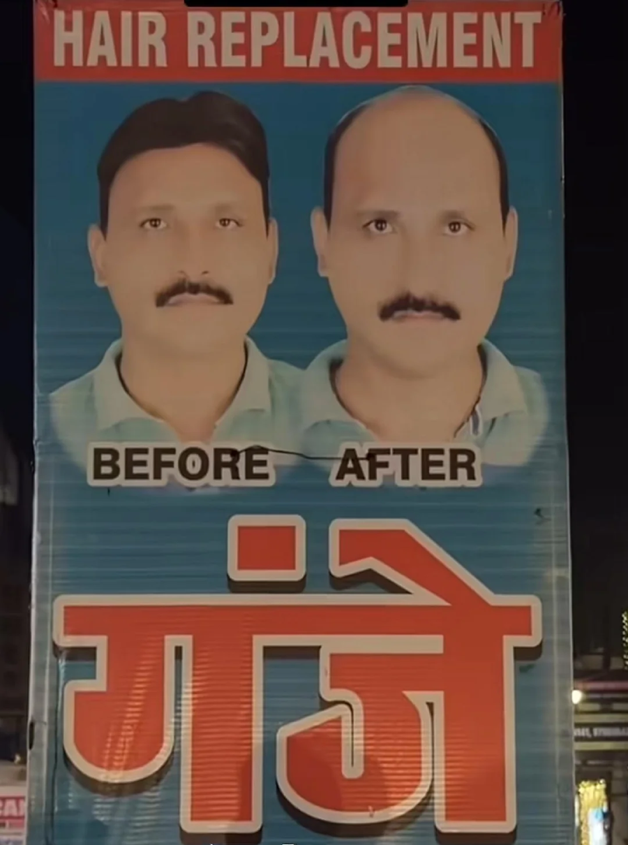 A sign for a hair replacement service shows two men: one with a full head of hair labeled "BEFORE," and one bald labeled "AFTER." Bold red text in Hindi is displayed below the images.