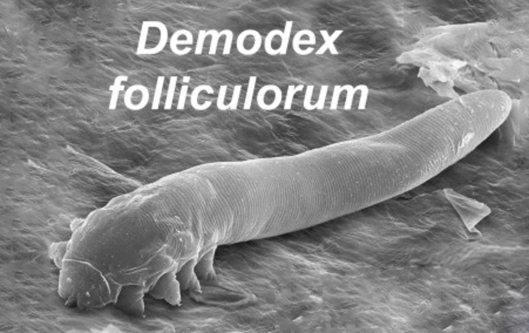 A magnified black and white image shows a Demodex folliculorum mite with a segmented, elongated body and tiny legs, crawling on a textured surface. The text "Demodex folliculorum" appears above the mite.