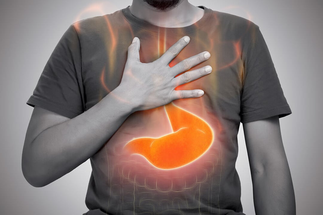 A person holds their chest with one hand, while a glowing illustration of a stomach is superimposed on their torso, symbolizing heartburn or digestive discomfort.