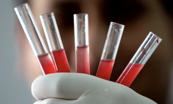 A gloved hand holds five test tubes containing a red liquid, with a blurred face in the background.