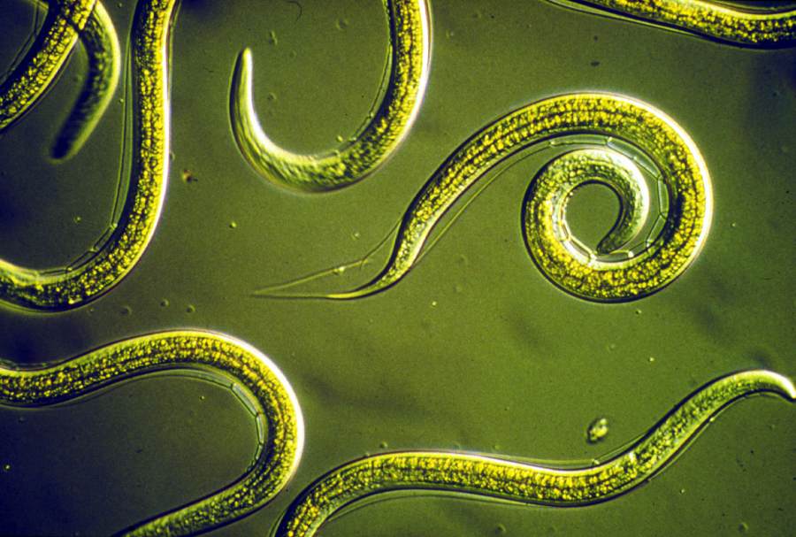 Close-up view of several thin, translucent nematode worms, showing their smooth, curved bodies under a microscope with a yellow-green tint.