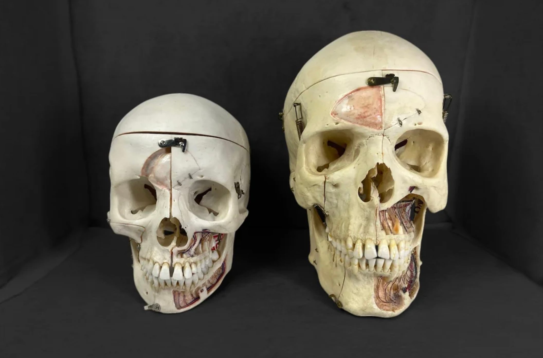 Two anatomical human skull models on a dark background, one smaller and one larger, each with removable sections and exposed interior features for educational display.