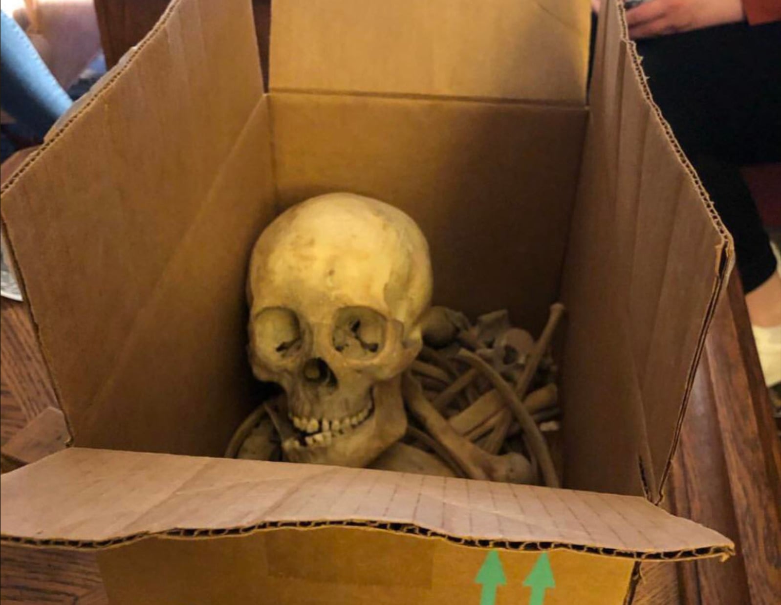 A cardboard box containing a human-like skull and bones, resting on a wooden surface. Part of a person's arm and legs are visible in the background.