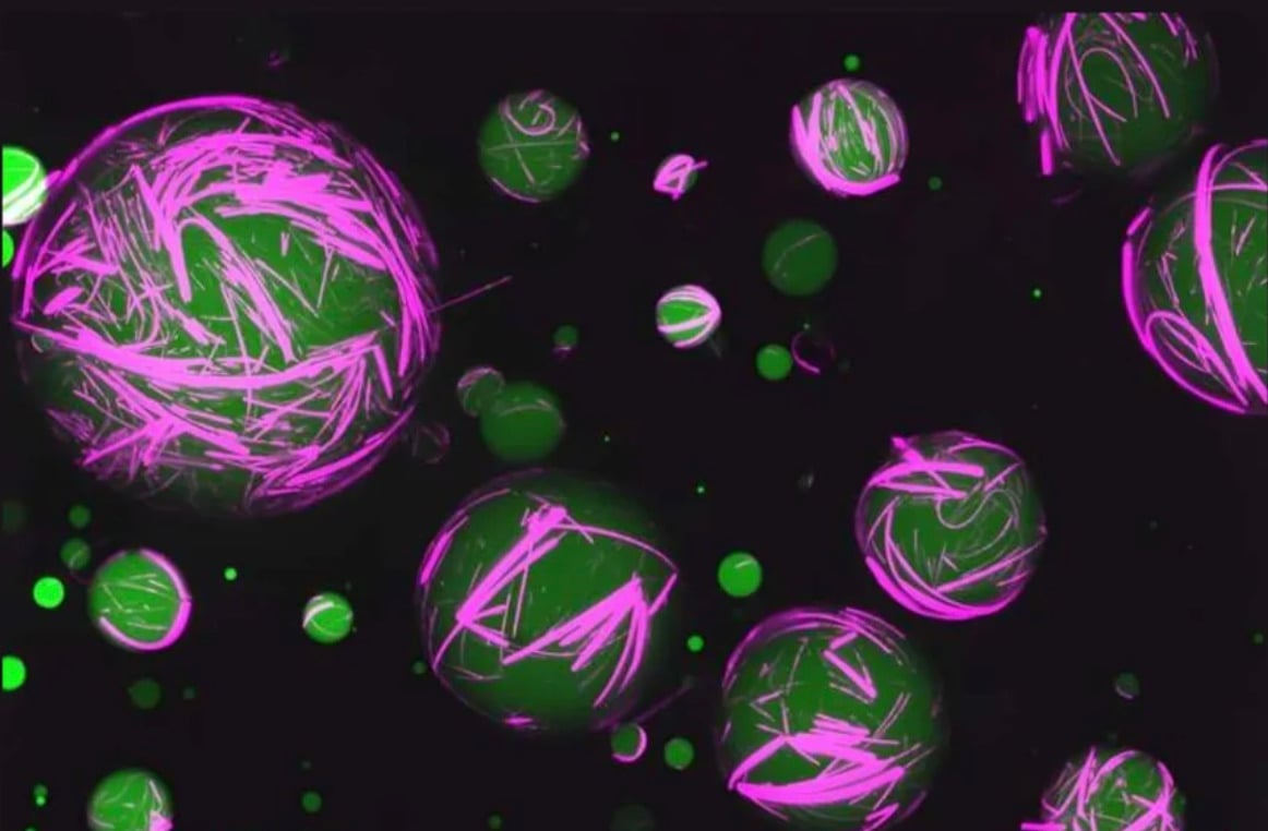 Green spheres of various sizes float against a dark background, covered with bright pink, jagged lines and patterns, giving a glowing, abstract, and science-inspired appearance.