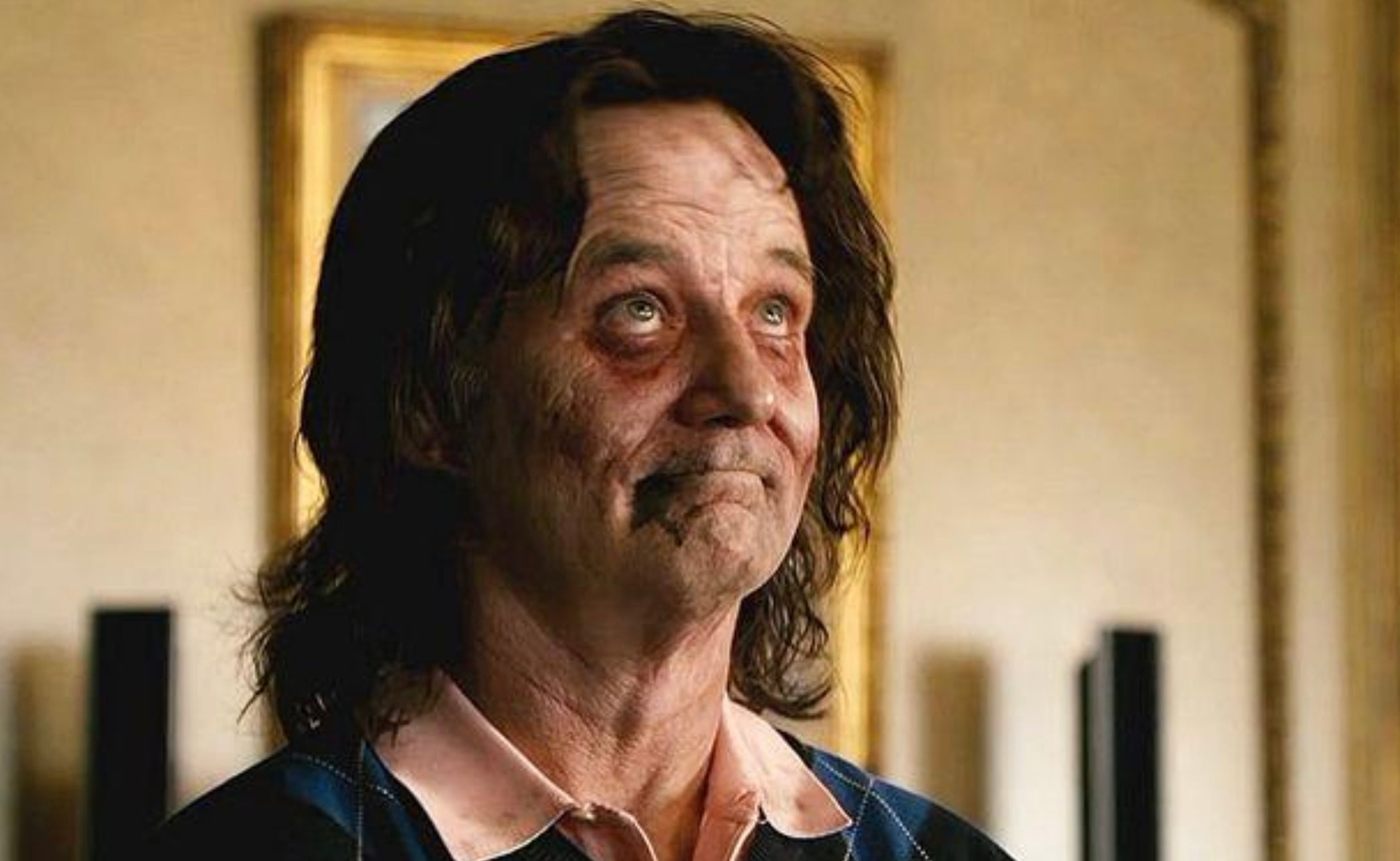 A man with long, messy hair and pale, bruised-looking skin gazes upward with a slight smile. He has dark circles around his eyes and wears a collared shirt with a sweater. The background is softly lit indoors.