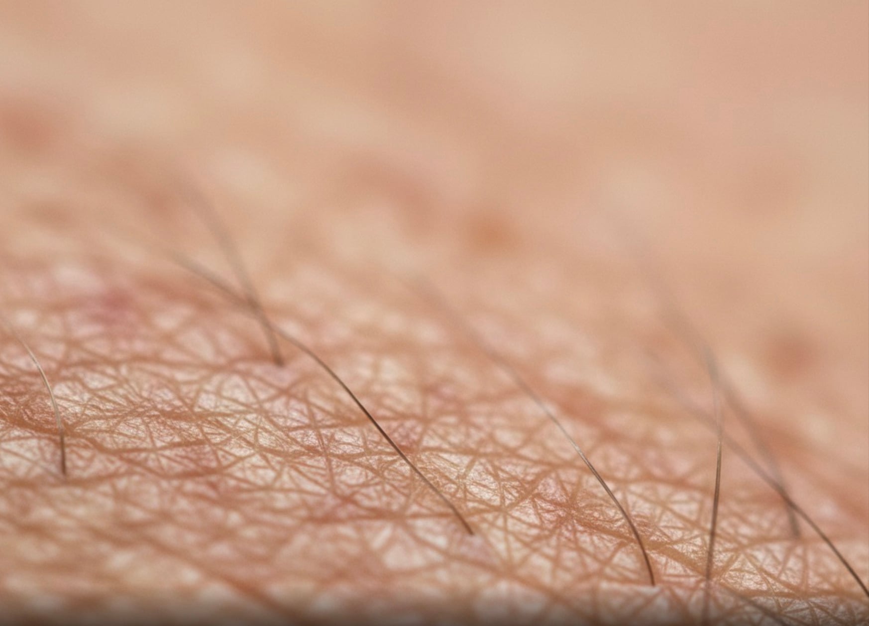 A close-up of human skin showing fine lines, pores, and several short, thin hairs, highlighting the natural texture and details of the skin’s surface.