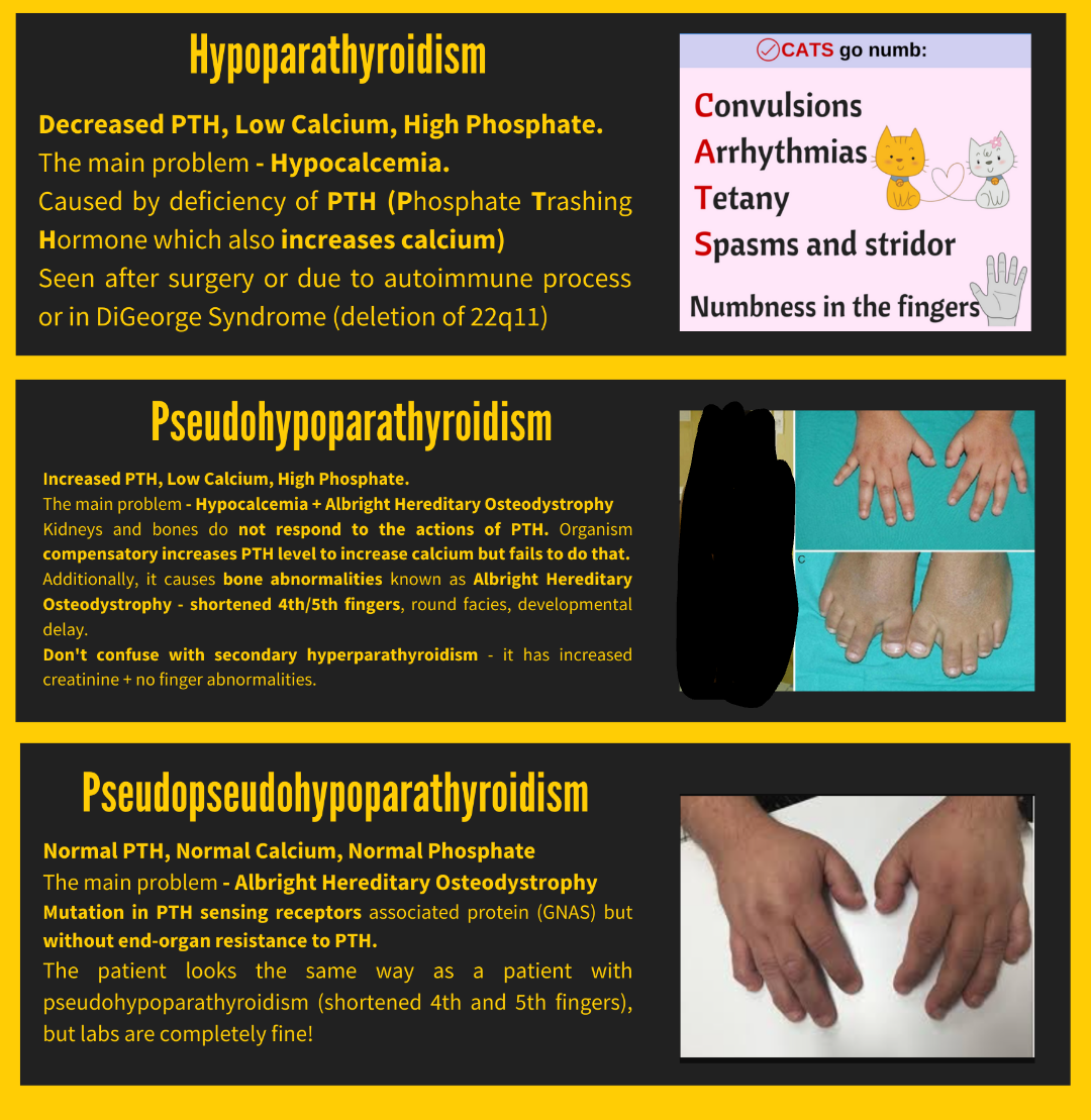 An infographic explaining hypoparathyroidism, pseudohypoparathyroidism, and pseudopseudohypoparathyroidism with key signs, symptoms, and images of hands showing abnormal finger positions.