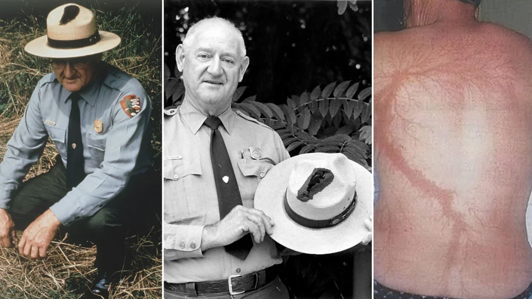 Three photos: On the left, an older park ranger in uniform and hat kneels outdoors. In the center, the same ranger, standing and holding his hat. On the right, a bare back displays a large, pale scar shaped like a lightning bolt.