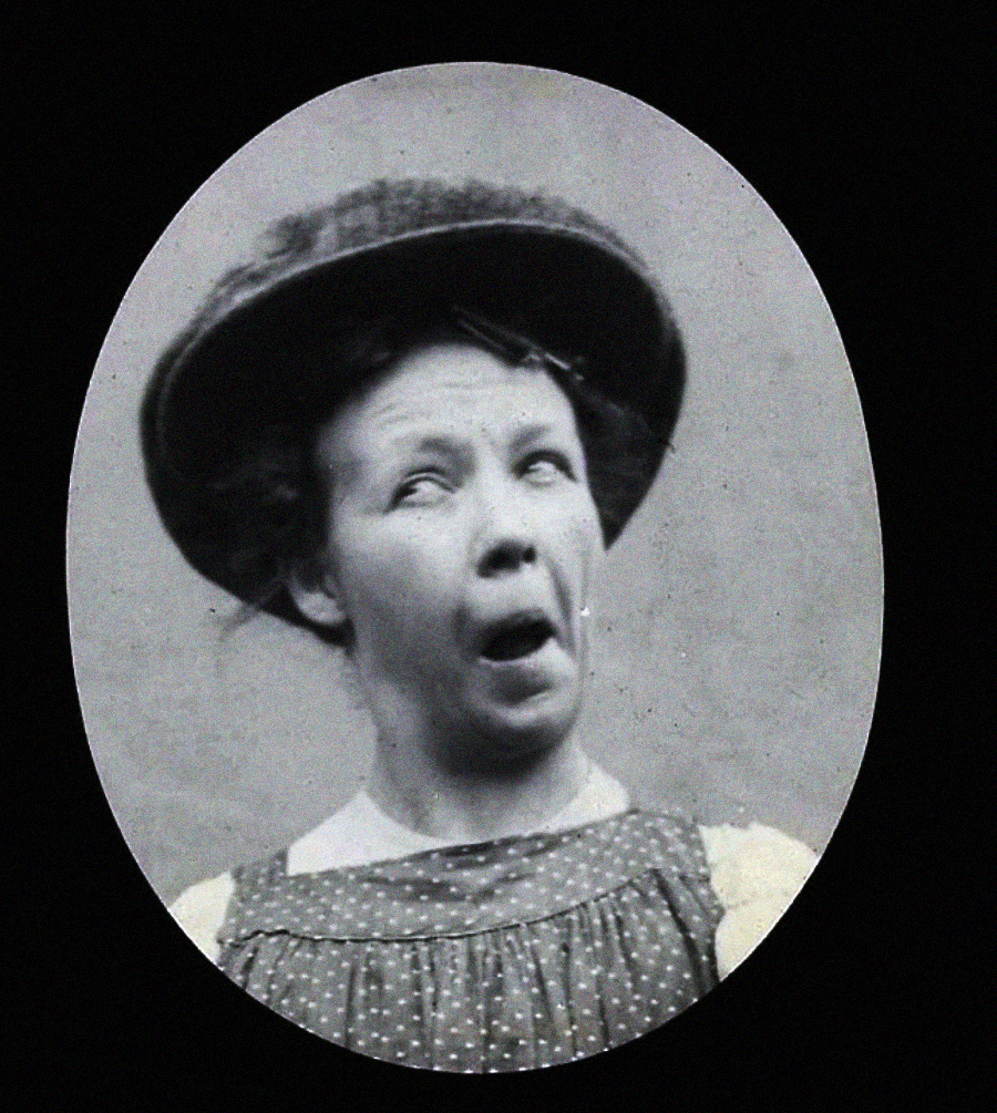 Black and white photo of a woman wearing a hat and a polka-dot dress, making a comical facial expression with crossed eyes and mouth open, set against a plain background in an oval frame.