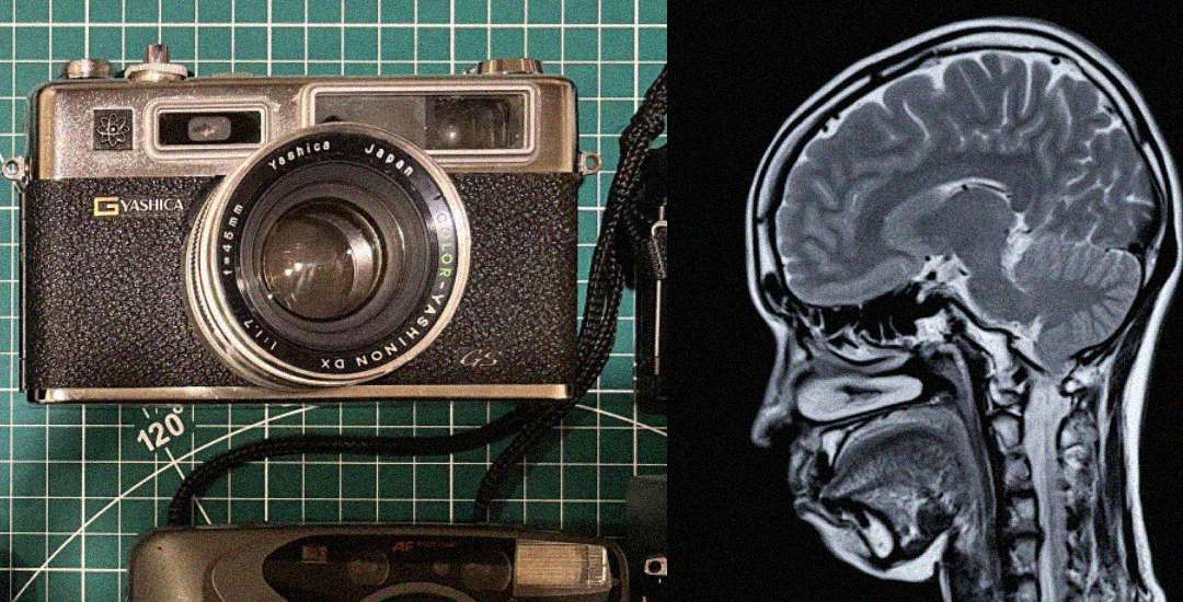 A vintage Yashica camera on a green grid surface is shown on the left, and a black-and-white side-view MRI image of a human head and brain is shown on the right.