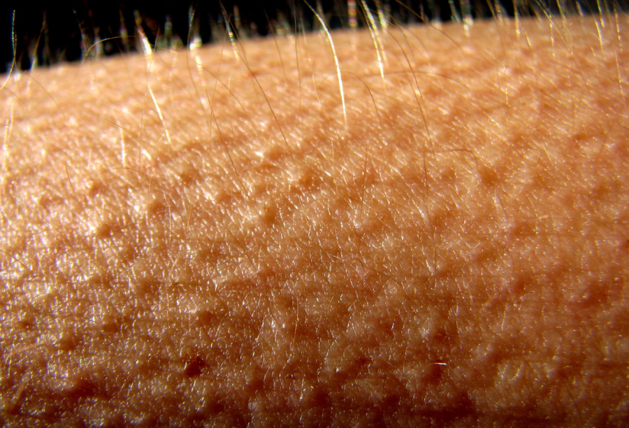 Close-up of human skin with visible pores and fine hairs, showing detailed texture and slight goosebumps.