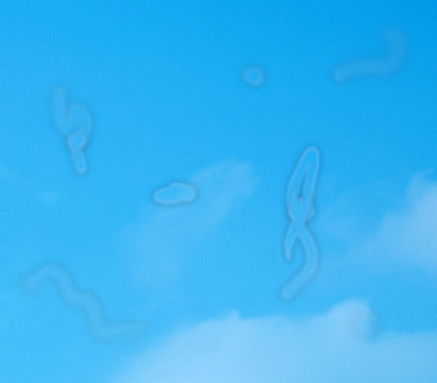 A blue sky with a few wispy clouds and several faint, squiggly, translucent shapes resembling floaters seen in vision.