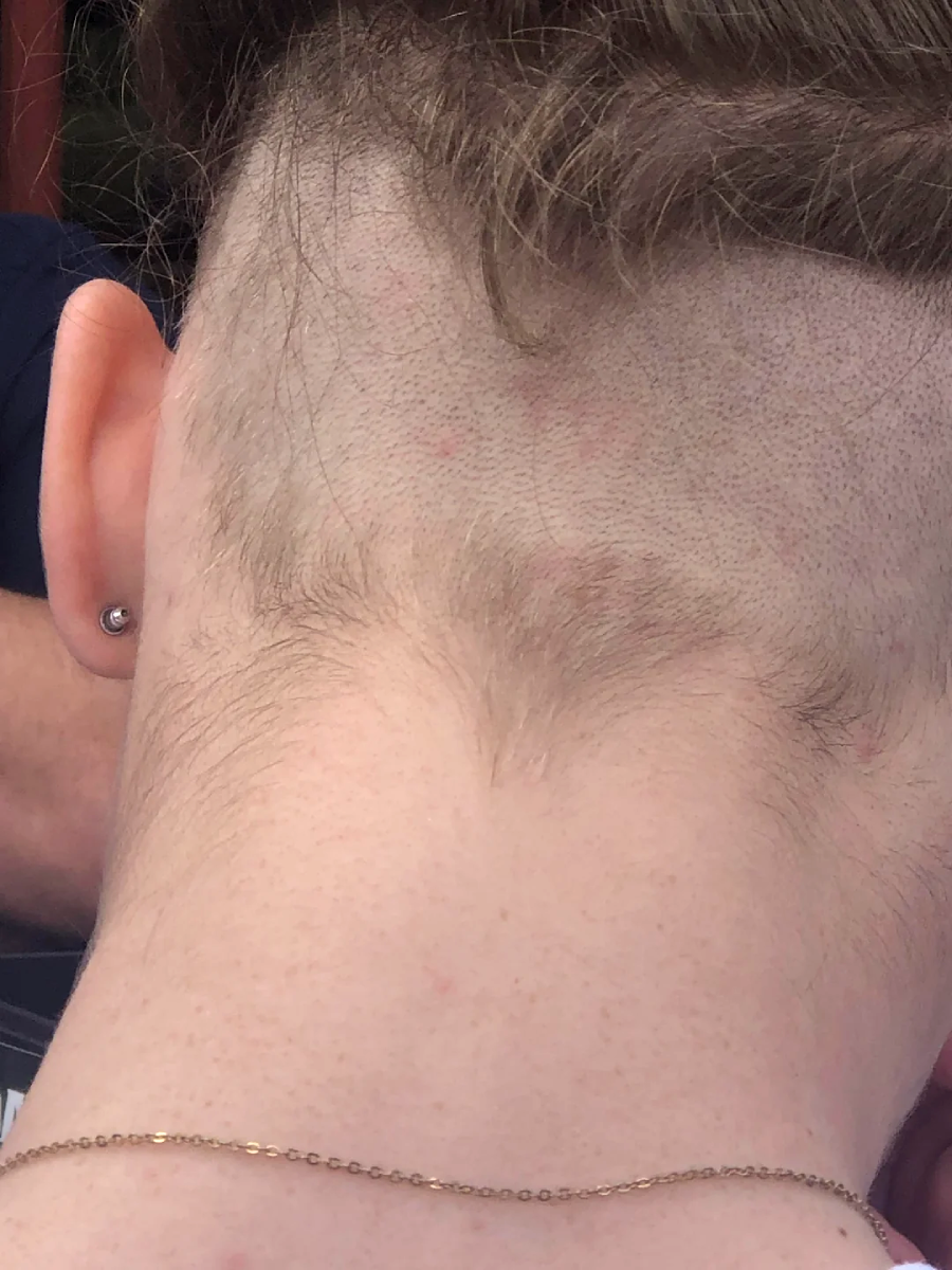 The back of a person's head showing a patchy, uneven haircut with some longer areas of hair left unshaven. The person is wearing a small earring and a thin gold chain necklace.