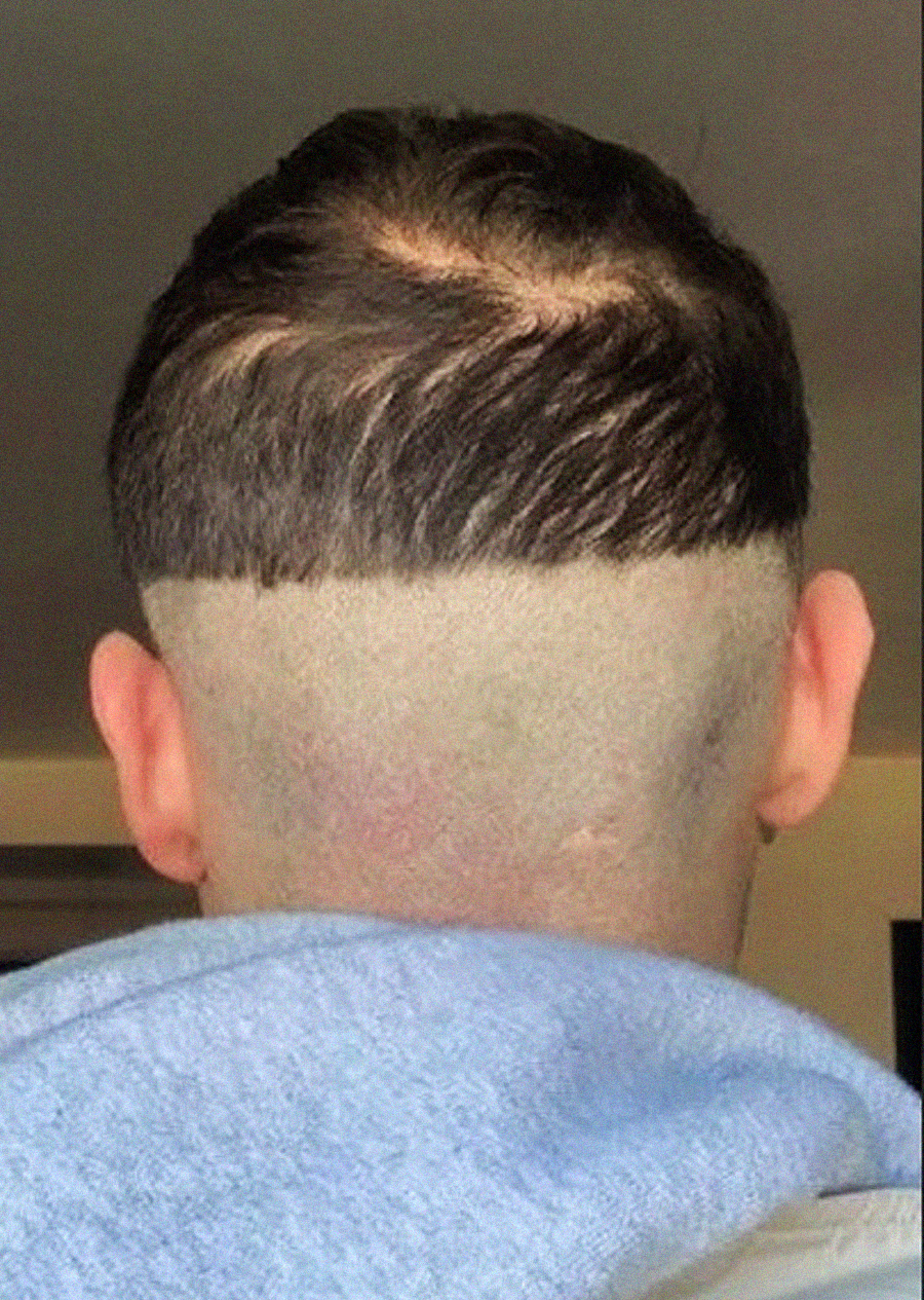 A person with very short hair on the lower half of their head and longer, uneven hair on top, viewed from behind. The haircut has a sharp line separating the two lengths.