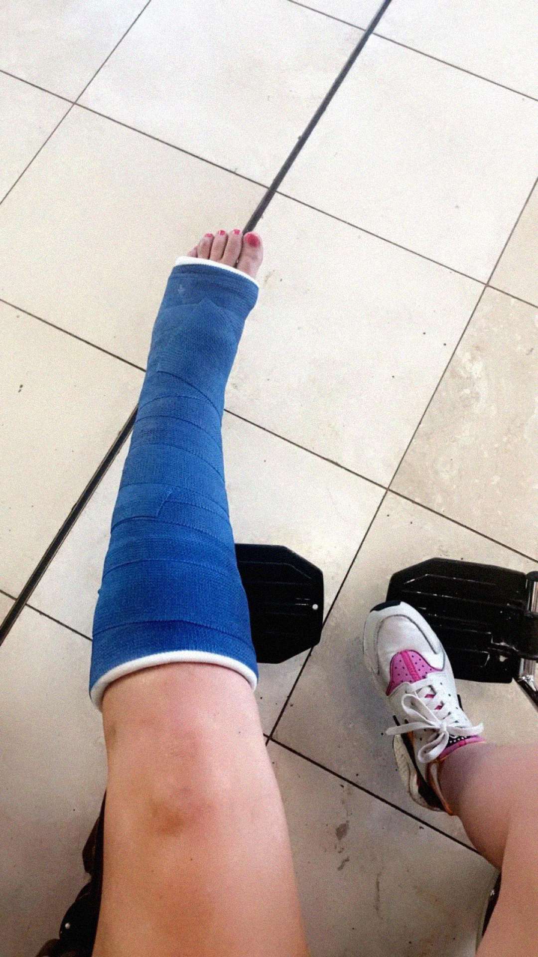 A person with a blue cast on their left leg sits in a wheelchair. Their right leg wears a white sneaker with pink details. The floor is tiled with light-colored tiles.