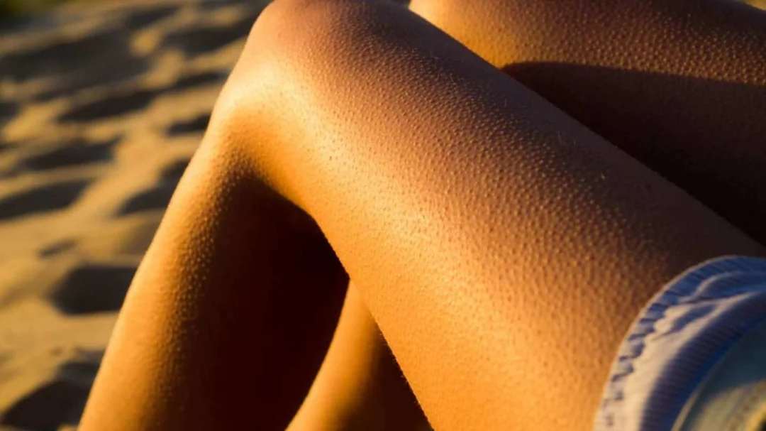 Close-up of a person's legs with visible goosebumps in warm sunlight, possibly at a beach or sandy area. The skin texture and lighting are clearly highlighted.