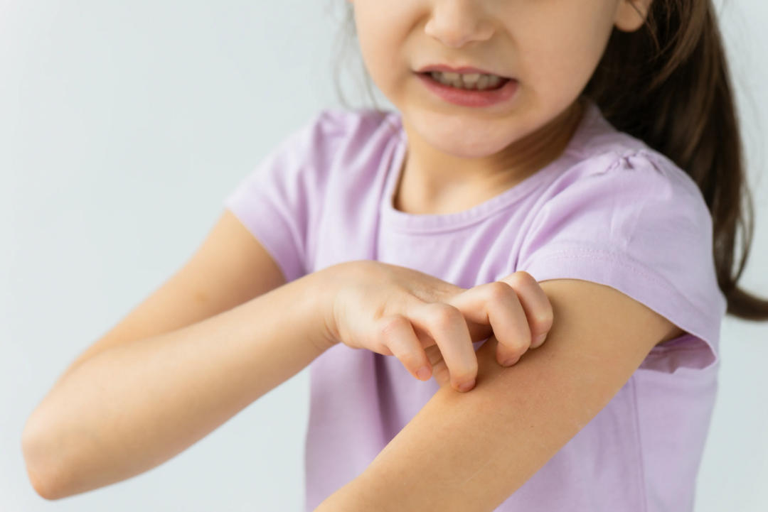 A young girl in a light purple shirt is scratching her forearm and appears uncomfortable or in pain, possibly due to itching or irritation.
