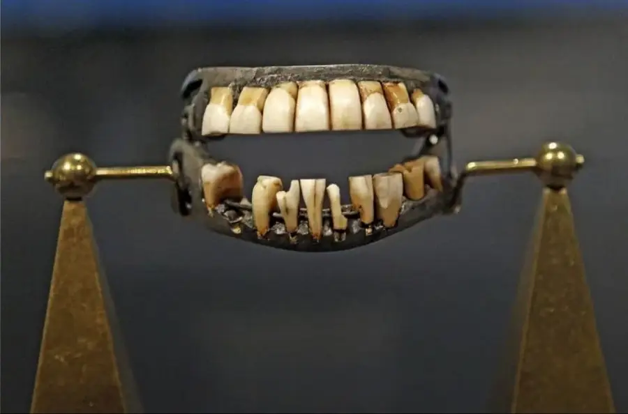 A close-up of an old set of false teeth, likely made from metal and human teeth, displayed on a stand with two brass supports on each side. The teeth appear stained and worn.