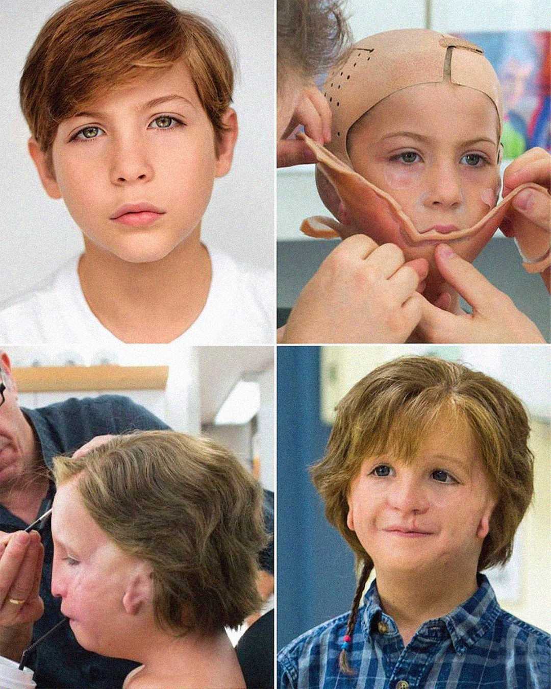 A child actor is shown in four images: a close-up portrait, wearing a bald cap and facial prosthetic, makeup being applied, and in full costume with prosthetics and a wig, portraying a character with facial differences.