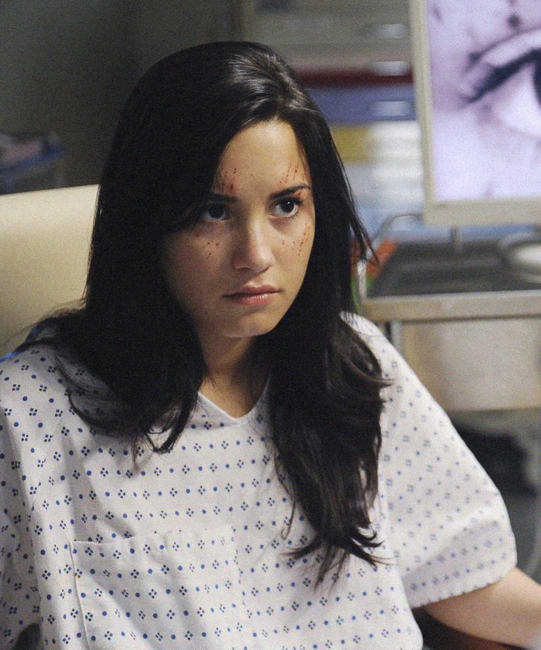 A young woman with long dark hair sits in a hospital gown, looking serious. She has scratches on her face and appears to be in a medical setting with equipment and blurred images in the background.