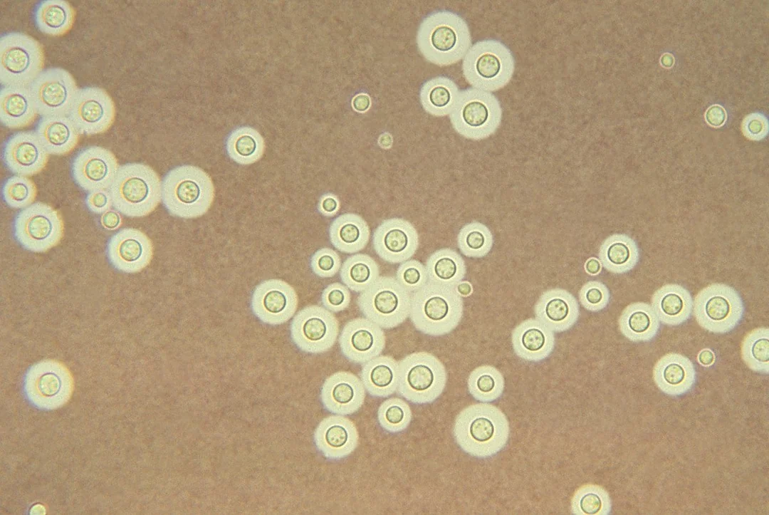 Microscopic view of numerous round, light-colored cells with clear edges scattered across a brownish background, resembling yeast or fungal cells.
