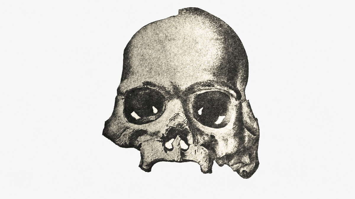 A black and white illustration of a human skull missing its jawbone, viewed from the front, on a plain white background.