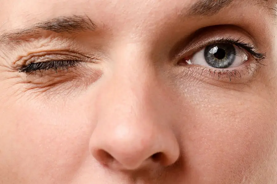 Close-up of a person's face showing one eye open and the other eye tightly shut, highlighting the skin texture and fine lines around the eyes.