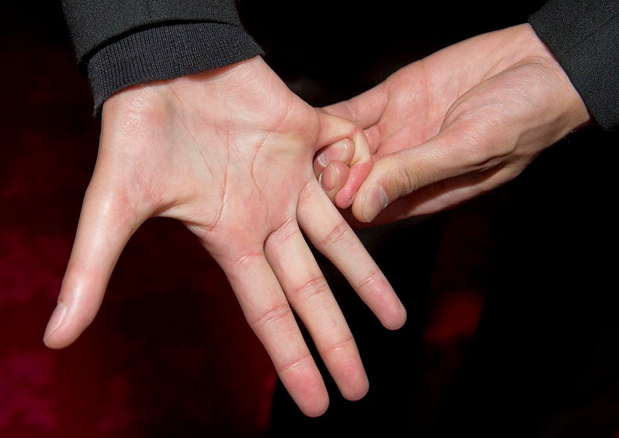 A person stretches their thumb backward with the other hand against a red background, demonstrating hypermobility or flexibility in the thumb joint.