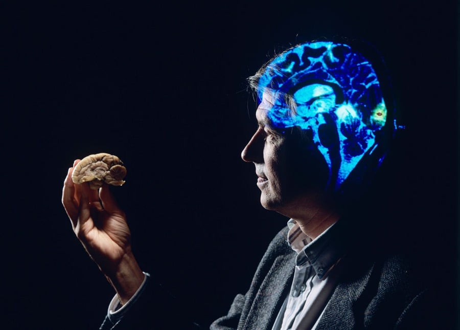 A man in profile holds a model brain, with a digital brain scan superimposed on his head, highlighting his brain’s anatomy in glowing blue against a dark background.