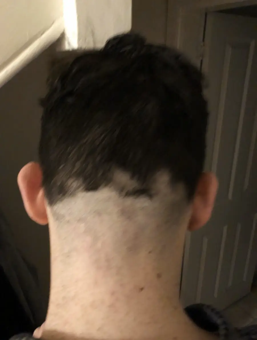 A person’s head viewed from behind, showing a poorly cut haircut with uneven, patchy, and shaved areas at the base of the neck.