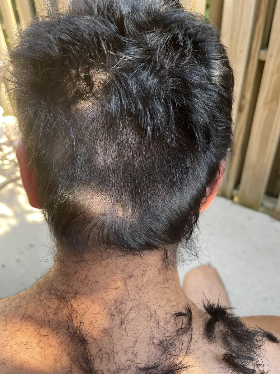 A person with dark hair sits outside, showing the back of their head mid-haircut, with unevenly shaved patches and loose hair clippings on their neck and shoulders. Wooden fence in the background.