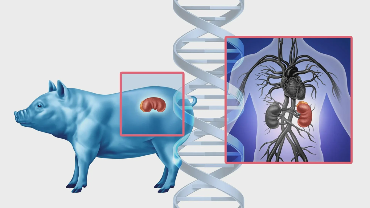 Illustration of a pig with its kidneys highlighted, next to a diagram of a human body with kidneys and circulatory system, overlaid on a DNA double helix, representing gene editing and organ transplantation.