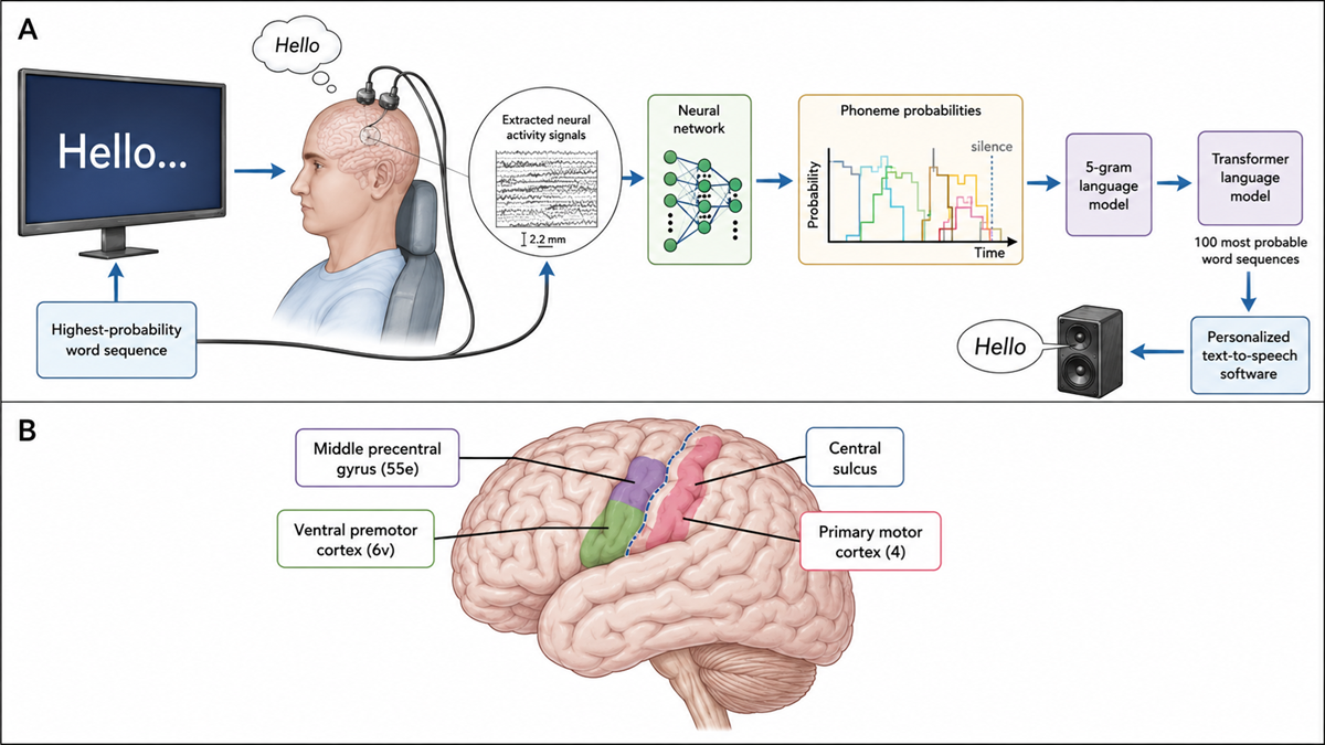 A diagram showing brain signal extraction to computer speech synthesis and locations of speech-related brain areas on a human brain illustration, labeled with colors and regions.