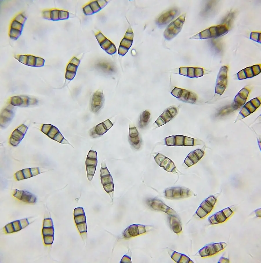 Microscopic view of spindle-shaped fungal spores with segmented interiors, scattered across a pale background. Each spore displays distinct horizontal bands.