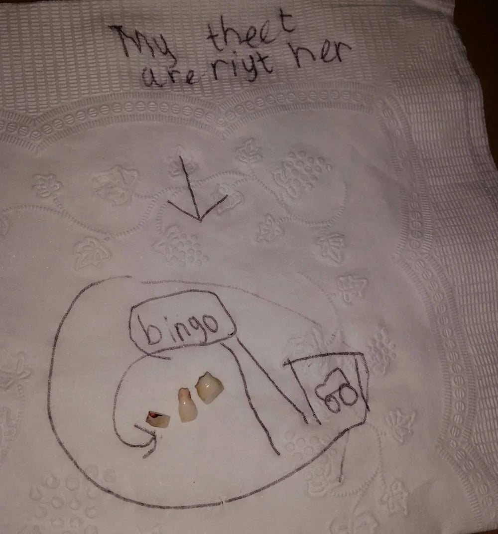 A napkin with “my teeth are right her” written in pen, an arrow, two small teeth, and a hand-drawn path labeled “bingo” leading to a car sketch.