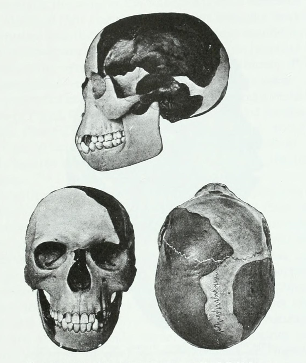 Three views of a human skull: a side profile, a front view, and a top-down view showing cranial sutures.