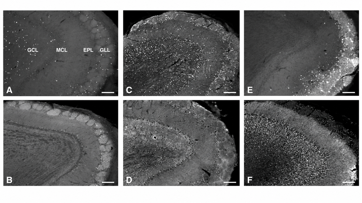 Six grayscale microscopy images labeled A through F showing varying densities of bright fluorescent markers in labeled tissue layers including the GCL, MCL, EPL, and GLL.